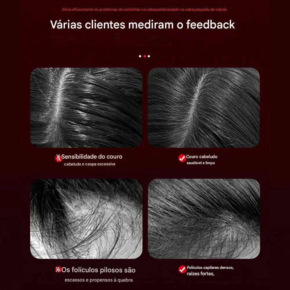 Escova e massageadora de cabeça para relaxamento do couro cabeludo e crescimento capilar, portátil a laser, terapia de luz.